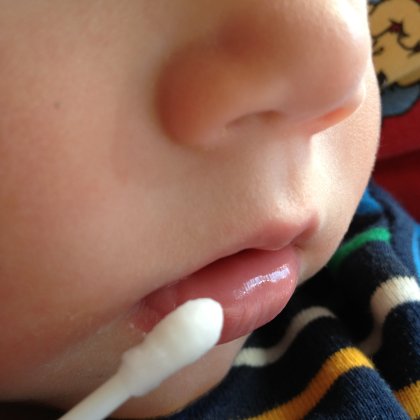 plastic Cotton swab or cotton buds on child mouth